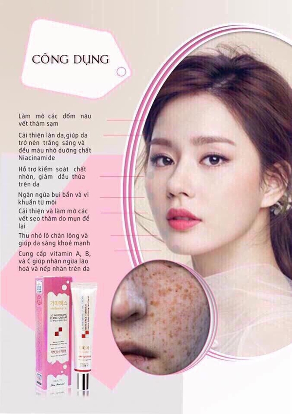 Kem trị thâm nám, tàn nhang Melasma-X 3D Whitening Clinic Cream
