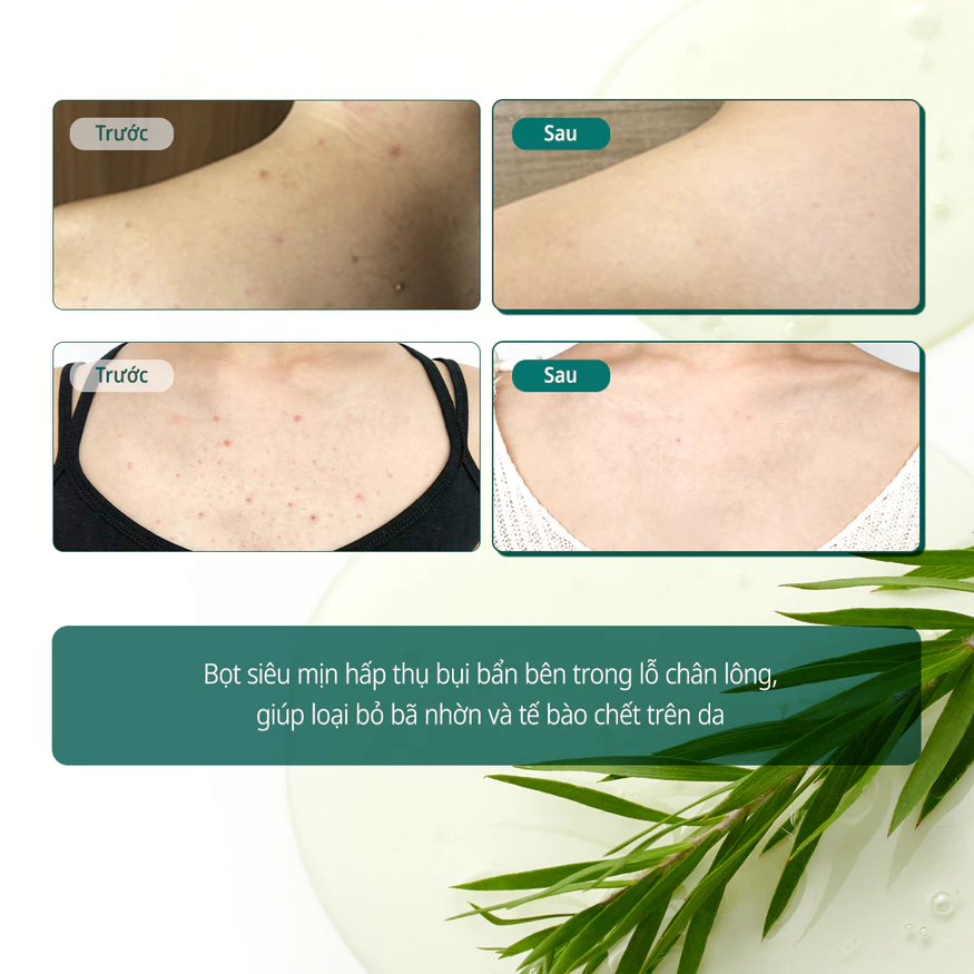 Sữa tắm Trị Mụn Some By Mi AHA-BHA-PHA