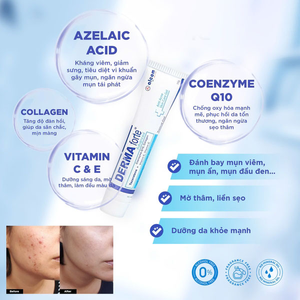 Gel Trị Mụn, Mờ Thâm Alcom Derma Forte Anti Acne 15g