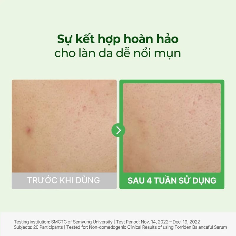 Torriden Balanceful Cica Serum