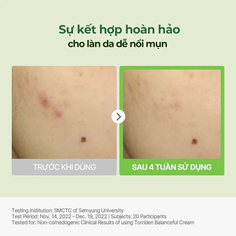 Kem Dưỡng Torriden Phục Hồi Da Mềm Mại Balanceful Cica Cream 80ml