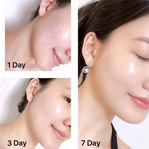 BỘ ĐÔI KEM DƯỠNG NGÀY/ĐÊM OLAY 7IN1