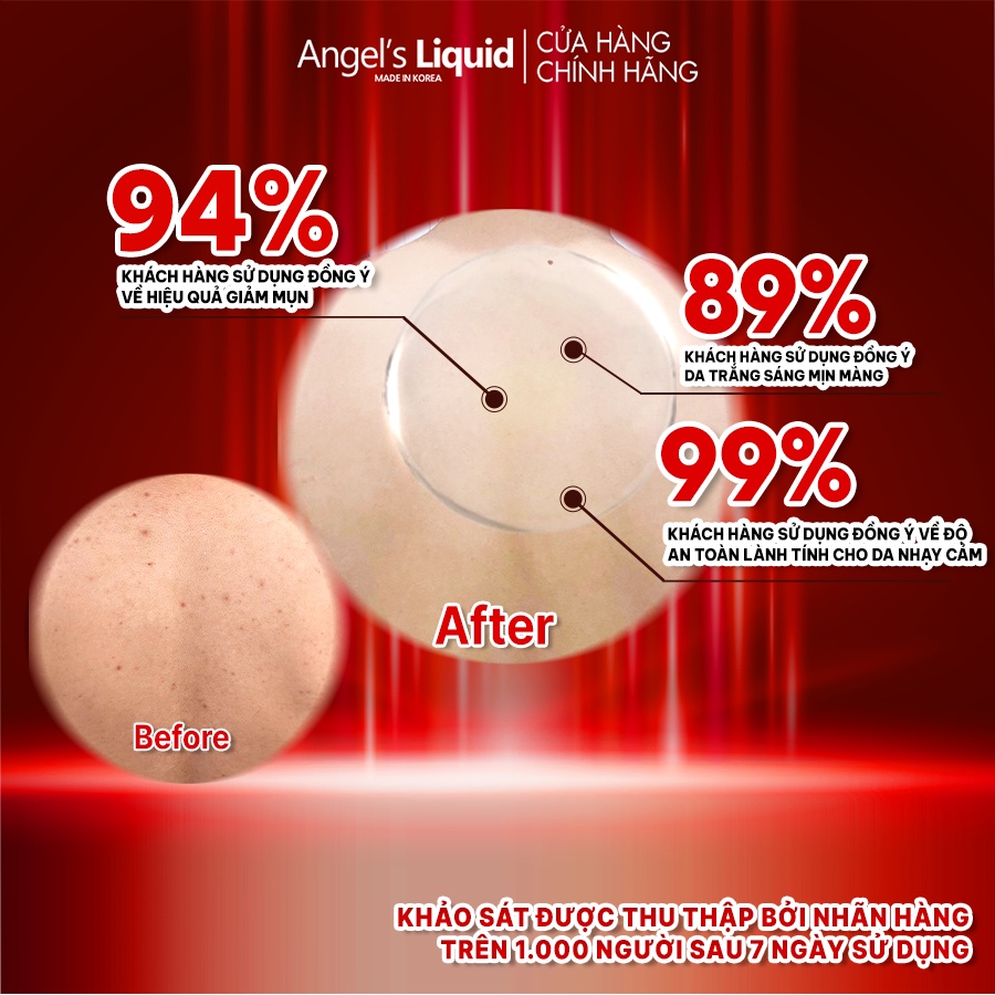 Xịt giảm mụn lưng dưỡng trắng cơ thể Angel's Liquid Glutathione Plus Centella Calming Body Mist 150ml